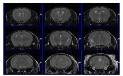 小動物用MRI マウス脳撮像画像